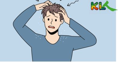 知多点｜ 头皮屑特別多 到底是啥原因？